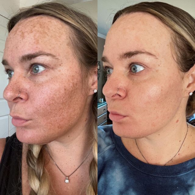 GlowFix Crème Correctrice