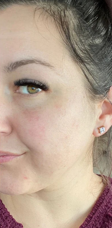 After - Résultats après 18 jours