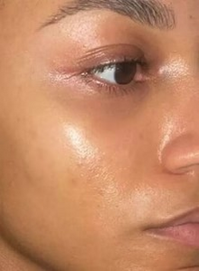 After - Résultats après 2 utilisations