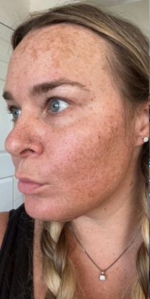 Before - Résultats après 18 jours