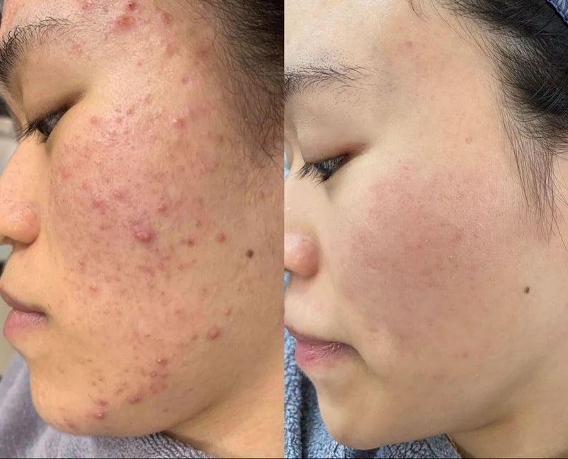 Crème Anti‑Taches – Teint Plus Uniforme