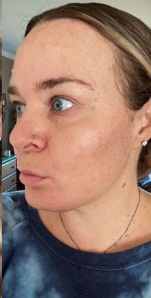 After - Résultats après 18 jours