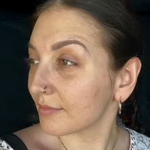 Before - Résultats après 7 jours